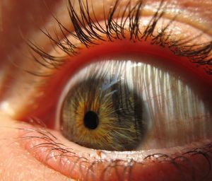 I have… squishy eyeball disease?